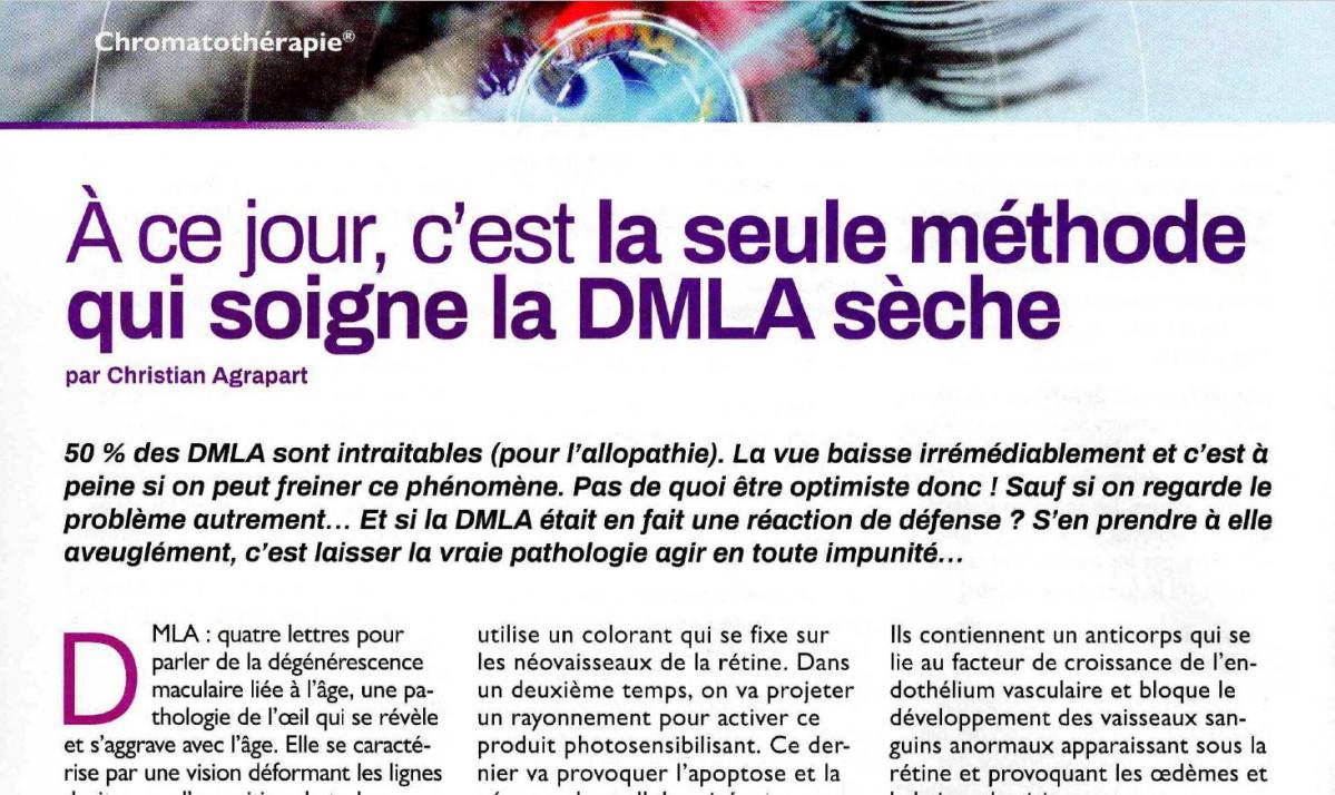 Article Christian Agrapart : DMLA